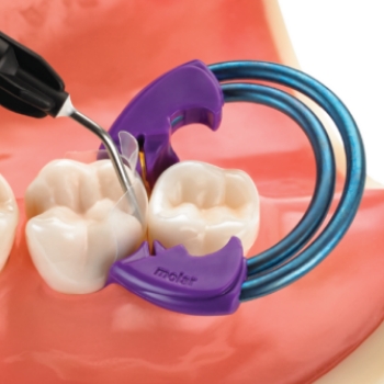 Two animated dental implants