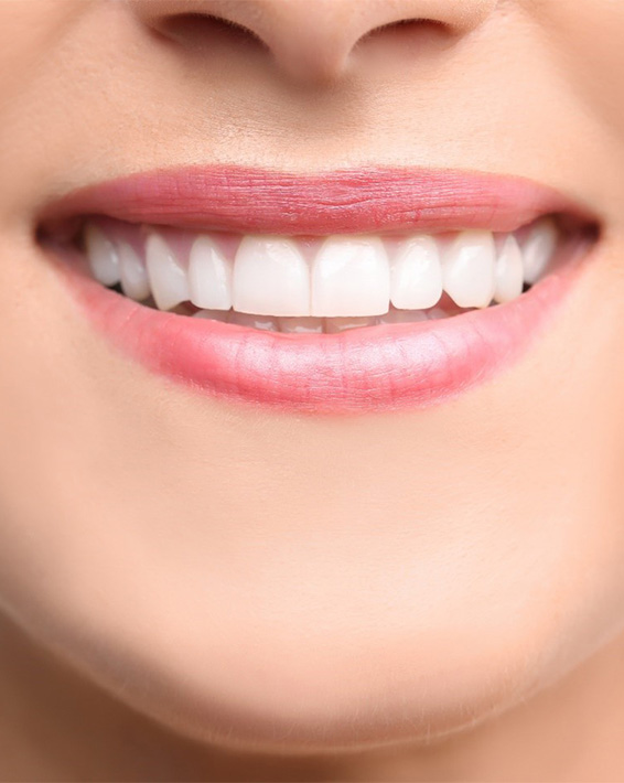A smile that’s gotten cosmetic dental bonding in Hampton