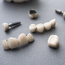 several dental implant crowns and bridges lying on a table