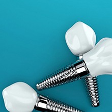 three dental implant posts with crowns in front of a blue background 