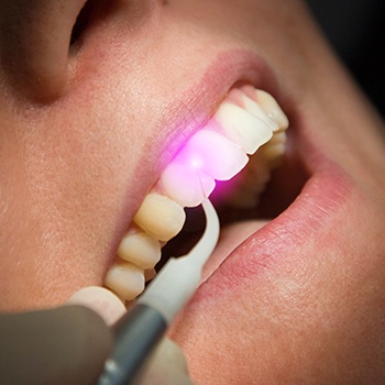 Patient receiving laser dentistry treatment