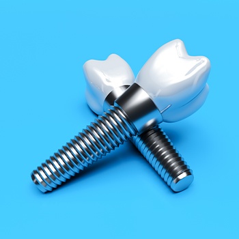 Two animated dental implants