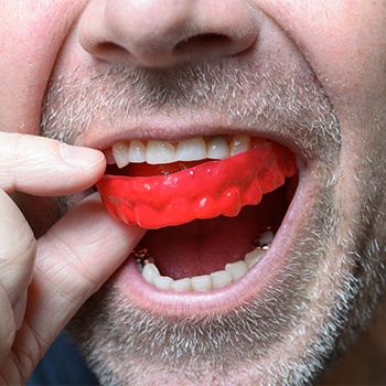 Man placing athletic mouthguard