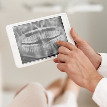 Panoramic dental x-rays on computer screen