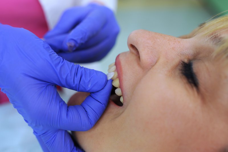 A woman receiving porcelain veneers from her dentist