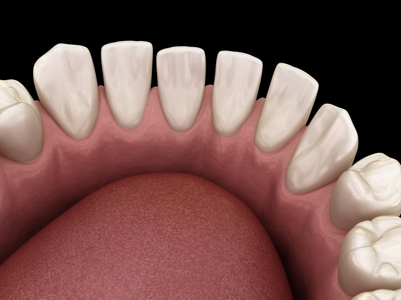 Illustration of gapped teeth